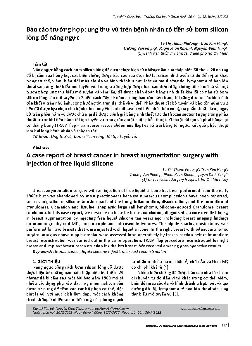 Báo cáo trường hợp: ung thư vú trên bệnh nhân có tiền sử bơm silicon lỏng để nâng ngực = A case report of breast cancer in breast augmentation surgery with injection of free liquid silicone