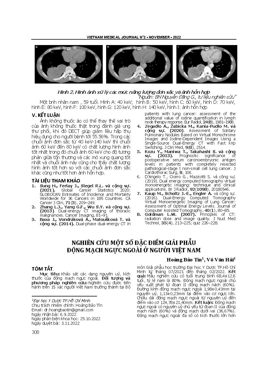 Nghiên cứu một số đặc điểm giải phẫu động mạch ngực ngoài ở người Việt Nam = Research on anatomical characteristics of the lateral thoracic artery in Vietnamese