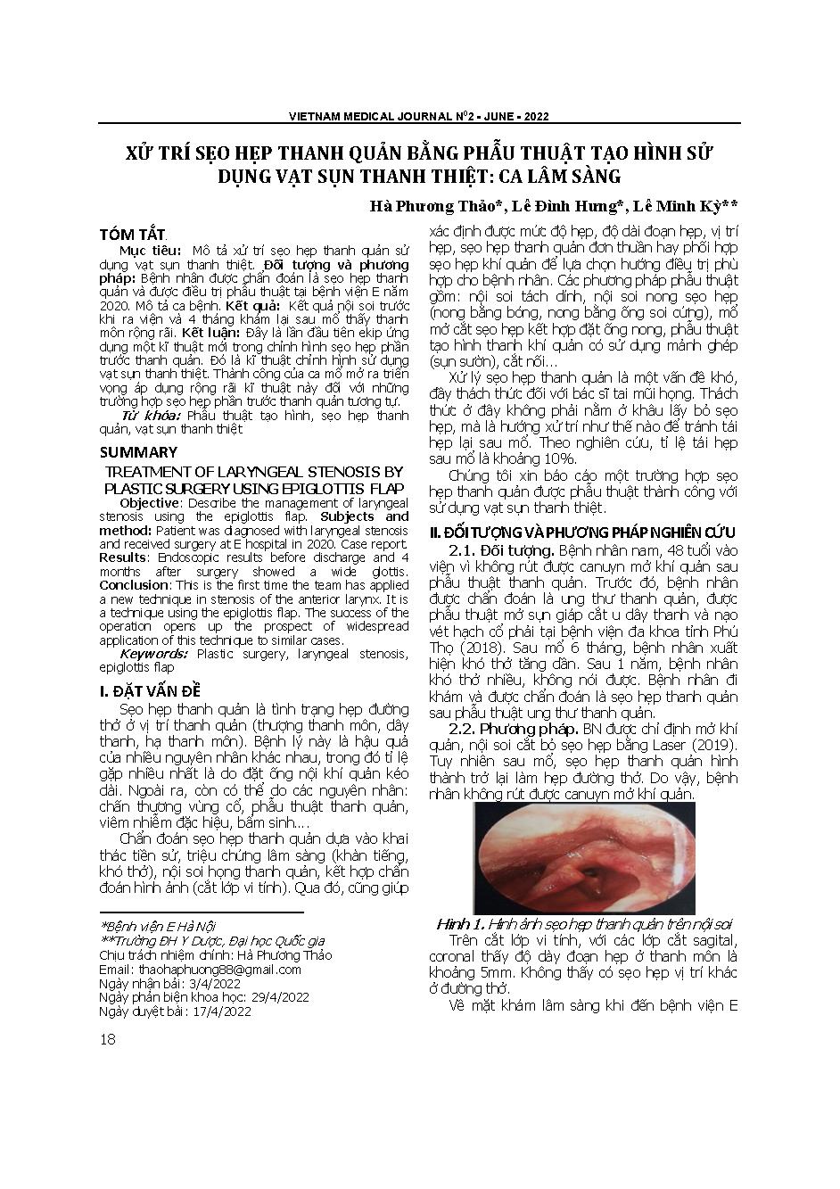Xử trí sẹo hẹp thanh quản bằng phẫu thuật tạo hình sử dụng vạt sụn thanh thiệt: Ca lâm sàng = Treatment of laryngeal stenosis by plastic surgery using epiglottis flap